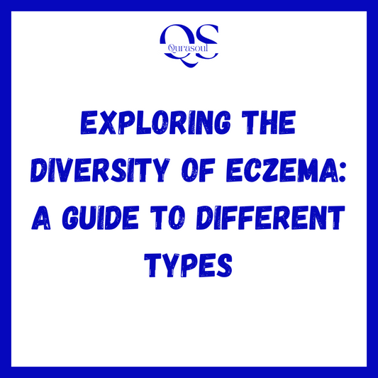 Exploring the Diversity of Eczema: A Guide to Different Types